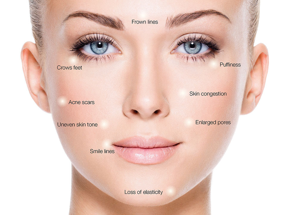 Dermal treatments Brighton